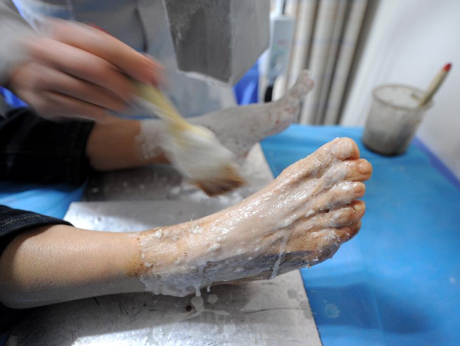 A woman receives keritherapy in the Shanxi College of Chinese Traditional Medicine Subsidiary Hospital in Taiyuan, capital of north China's Shanxi Province, Nov. 23, 2012. More and more Chinese are disposed to preventive treatment of discease rather than curative treatment, they receive acupuncture, moxibustion, herbal paste or other Chinese traditional regimen to improve sub-healthy state.(Xinhua/Yan Yan) 